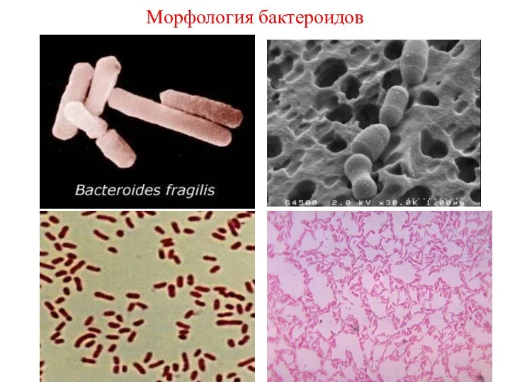 Морфология бактероидов