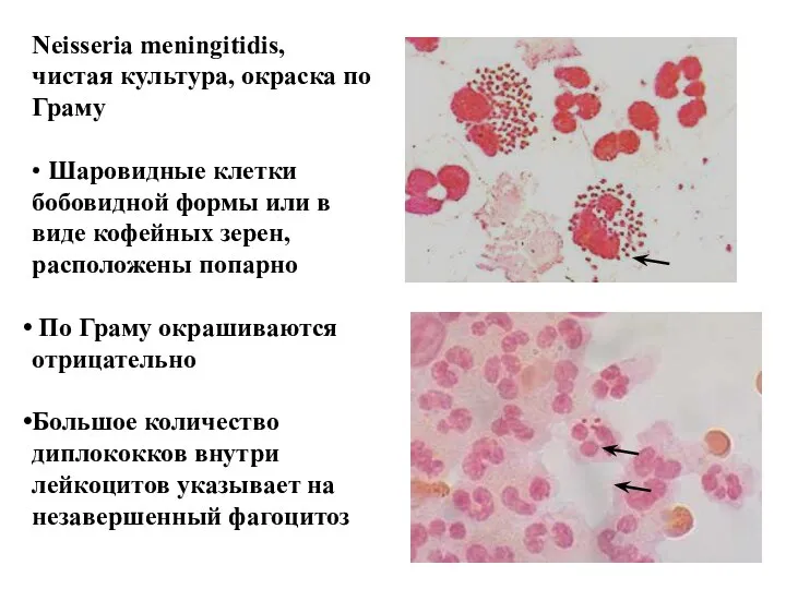 Neisseria meningitidis, чистая культура, окраска по Граму • Шаровидные клетки