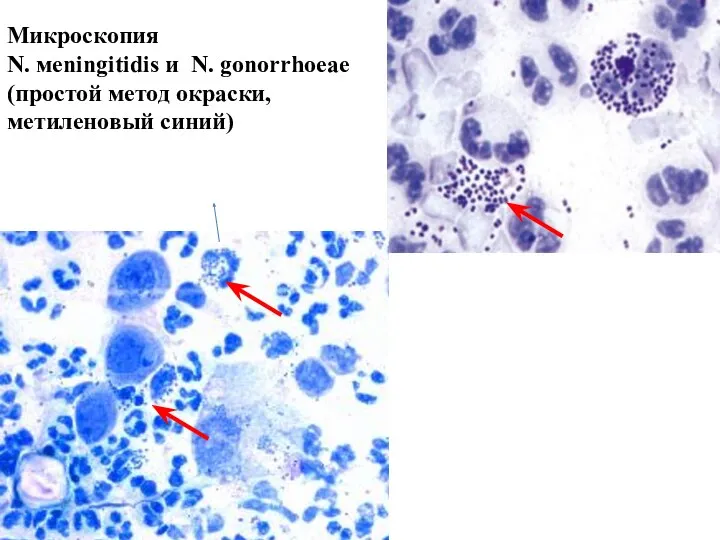 Микроскопия N. мeningitidis и N. gonorrhoeae (простой метод окраски, метиленовый синий)