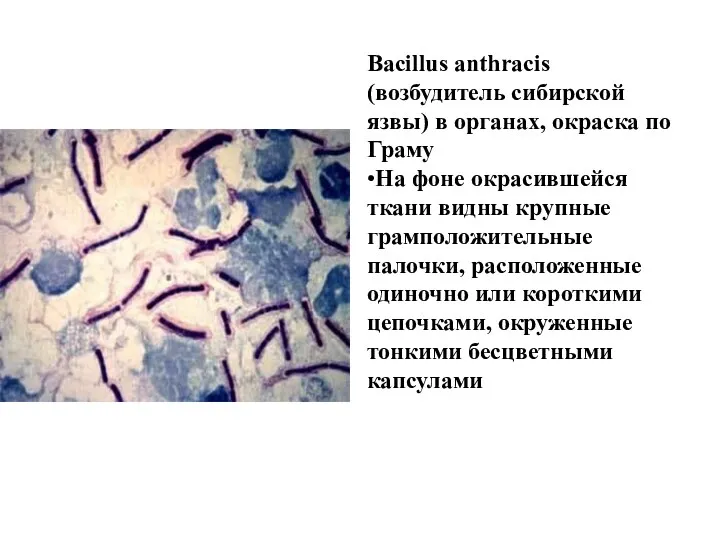 Bacillus anthracis (возбудитель сибирской язвы) в органах, окраска по Граму