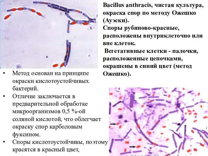 Bacillus anthracis, чистая культура, окраска спор по методу Ожешко (Ауэски).