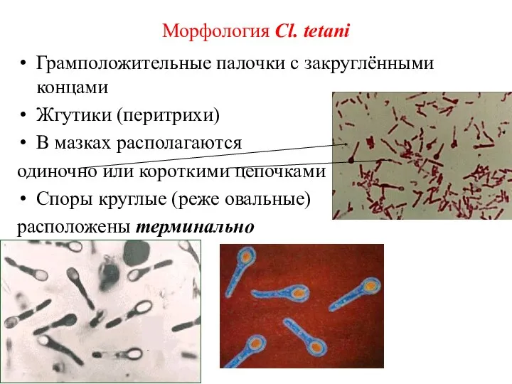 Морфология Cl. tetani Грамположительные палочки с закруглёнными концами Жгутики (перитрихи)