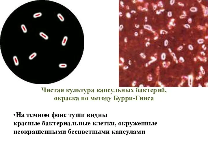 Чистая культура капсульных бактерий, окраска по методу Бурри-Гинса •На темном