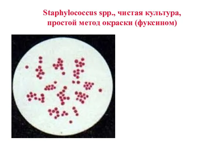 Staphylococcus sрр., чистая культура, простой метод окраски (фуксином)