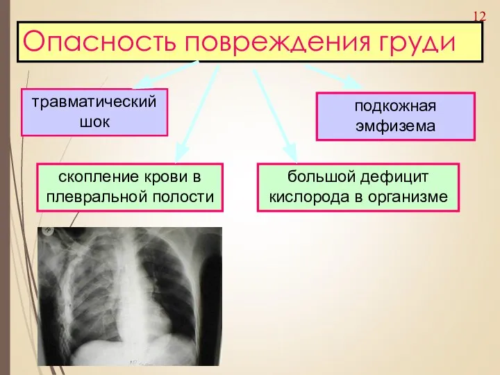 Опасность повреждения груди скопление крови в плевральной полости подкожная эмфизема большой дефицит кислорода