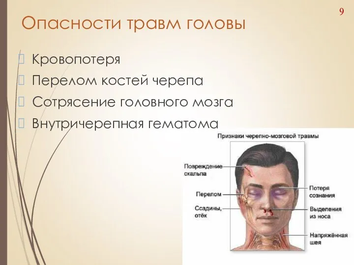 Опасности травм головы Кровопотеря Перелом костей черепа Сотрясение головного мозга Внутричерепная гематома