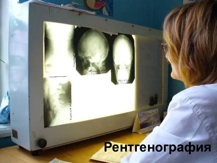 Рентгенография