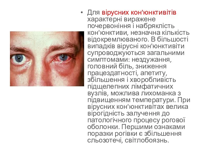 Для вірусних кон'юнктивітів характерні виражене почервоніння і набряклість кон'юнктиви, незначна кількість відокремлюваного. В