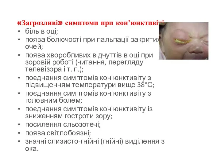 «Загрозливі» симптоми при конʼюнктивіті біль в оці; поява болючості при