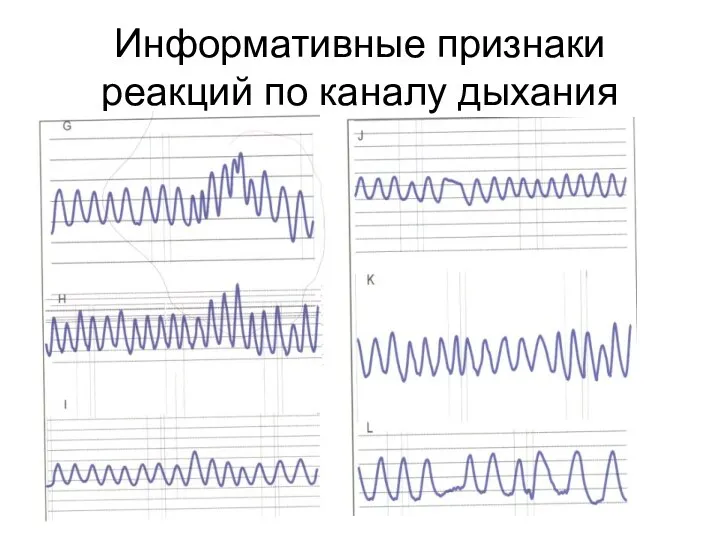 Информативные признаки реакций по каналу дыхания