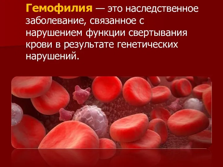 Гемофилия — это наследственное заболевание, связанное с нарушением функции свертывания крови в результате генетических нарушений.