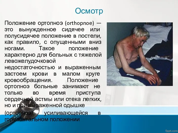 Осмотр Положение ортопноэ (orthopnoe) — это вынужденное сидячее или полусидячее