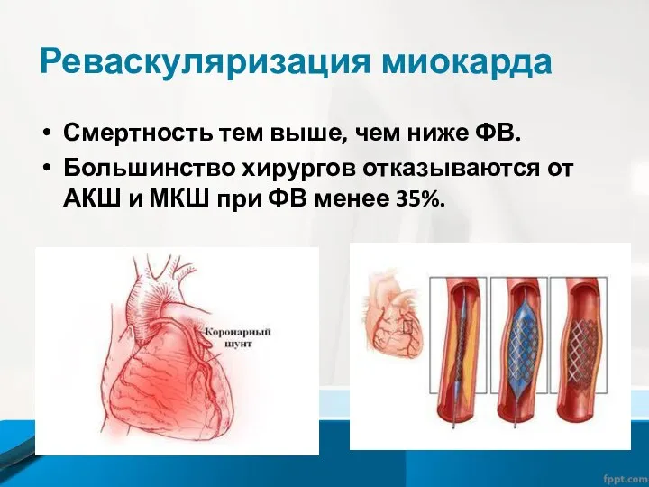 Реваскуляризация миокарда Смертность тем выше, чем ниже ФВ. Большинство хирургов