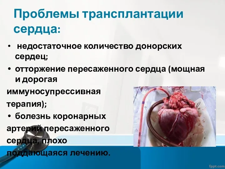 Проблемы трансплантации сердца: недостаточное количество донорских сердец; отторжение пересаженного сердца