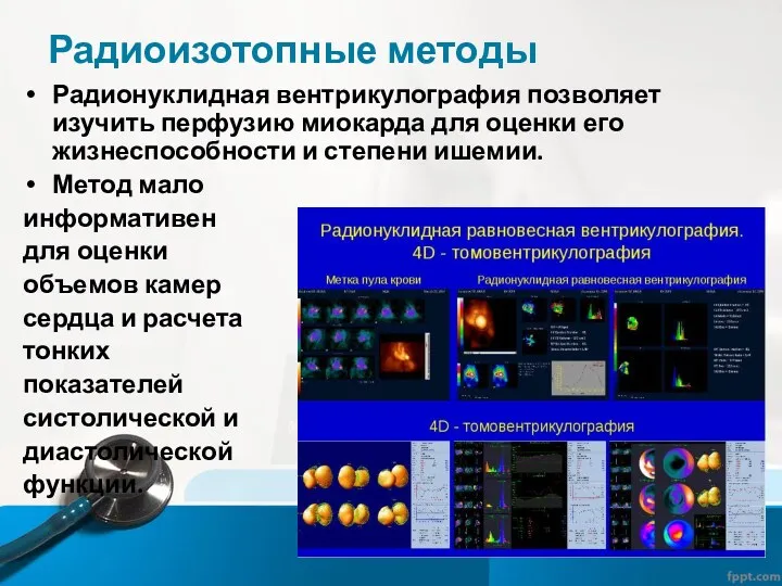 Радиоизотопные методы Радионуклидная вентрикулография позволяет изучить перфузию миокарда для оценки