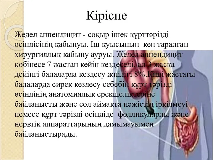 Кіріспе Жедел аппендицит - соқыр ішек құрттəрізді өсіндісінің қабынуы. Іш қуысының кең таралған