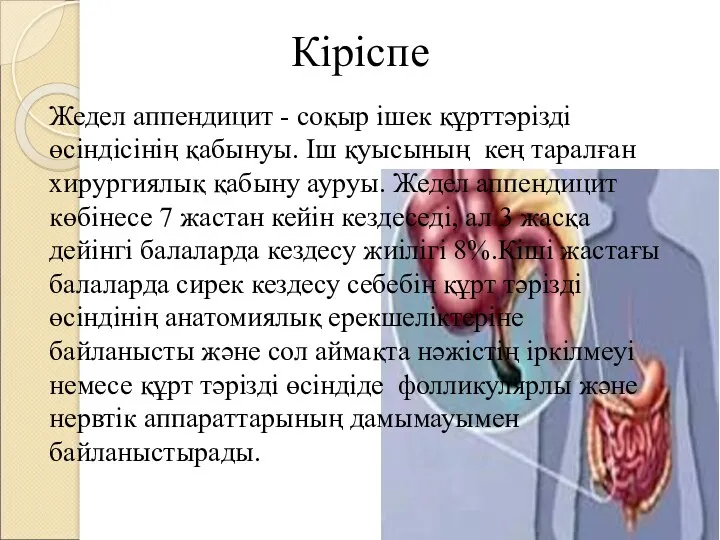 Кіріспе Жедел аппендицит - соқыр ішек құрттəрізді өсіндісінің қабынуы. Іш