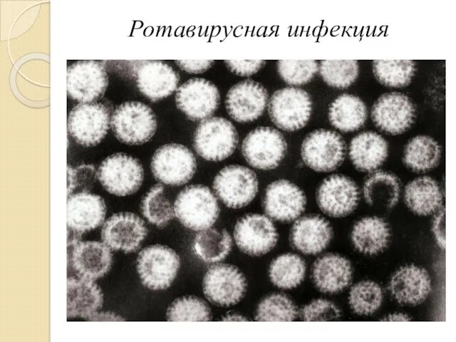 Ротавирусная инфекция