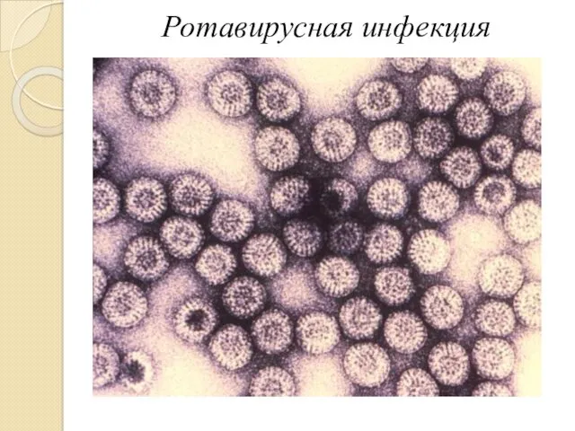 Ротавирусная инфекция