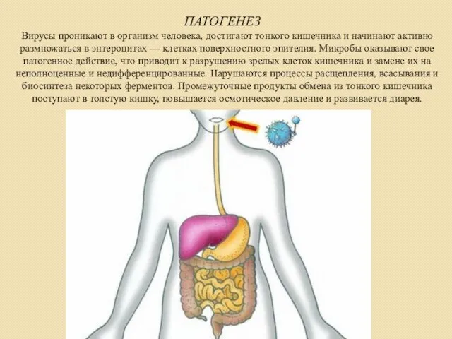 ПАТОГЕНЕЗ Вирусы проникают в организм человека, достигают тонкого кишечника и