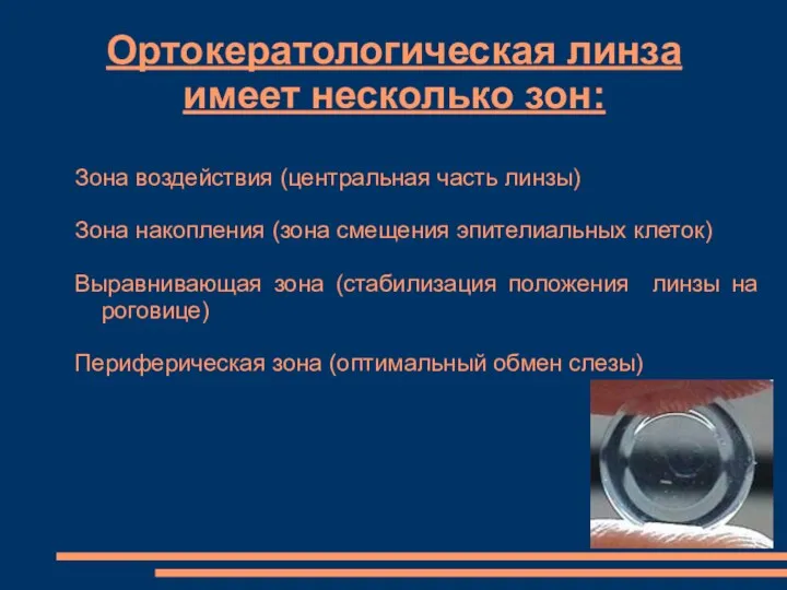 Ортокератологическая линза имеет несколько зон: Зона воздействия (центральная часть линзы) Зона накопления (зона