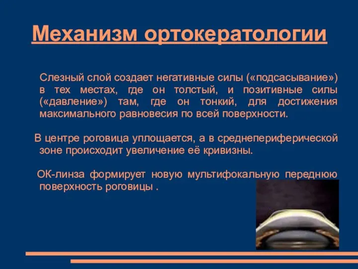 Механизм ортокератологии Слезный слой создает негативные силы («подсасывание») в тех местах, где он