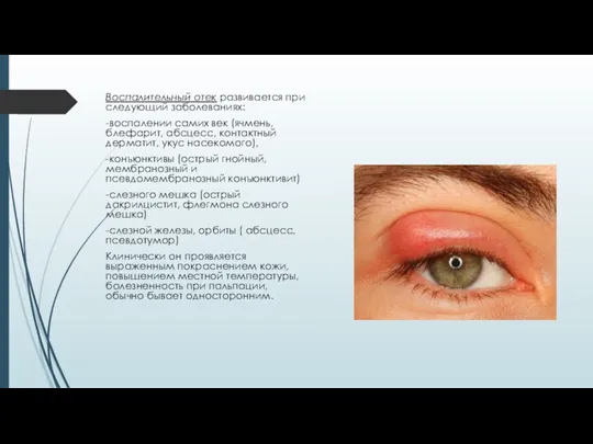 Воспалительный отек развивается при следующий заболеваниях: -воспалении самих век (ячмень,