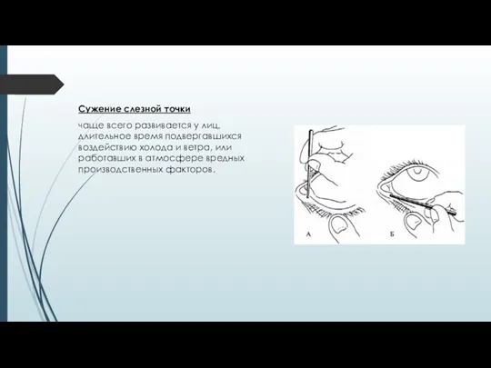 Сужение слезной точки чаще всего развивается у лиц, длительное время