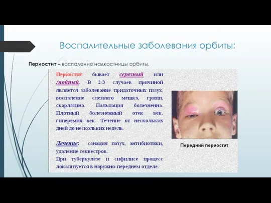 Воспалительные заболевания орбиты: Периостит – воспаление надкостницы орбиты.