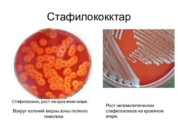 Стафилококктар Вокруг колоний видны зоны полного гемолиза Рост негемолитических стафилококков на кровяном агаре.