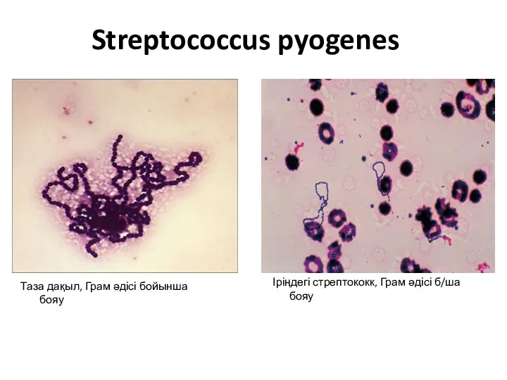 Streptococcus pyogenes Іріңдегі стрептококк, Грам әдісі б/ша бояу Таза дақыл, Грам әдісі бойынша бояу