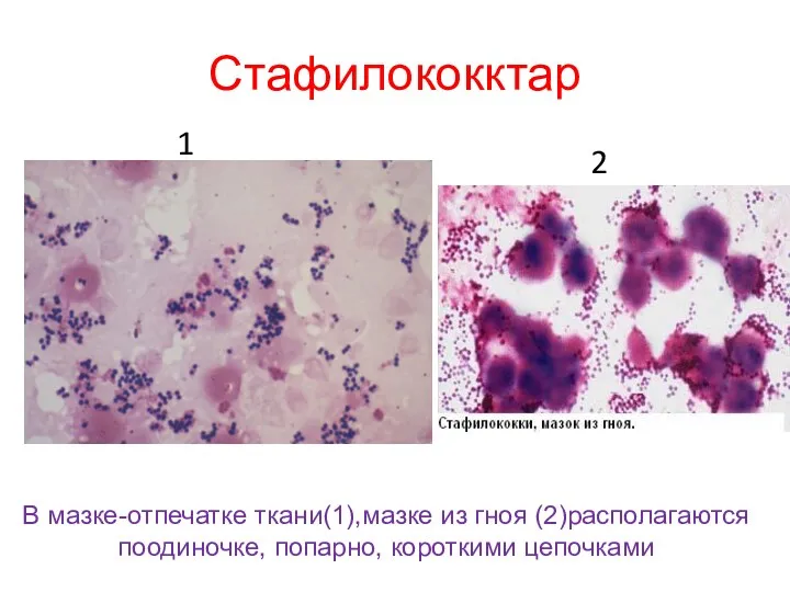 Стафилококктар В мазке-отпечатке ткани(1),мазке из гноя (2)располагаются поодиночке, попарно, короткими цепочками 1 2