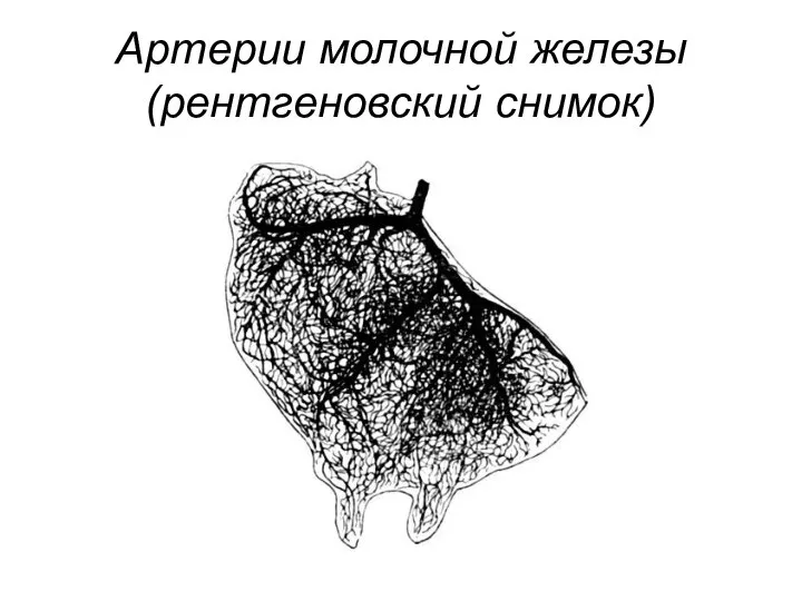 Артерии молочной железы (рентгеновский снимок)