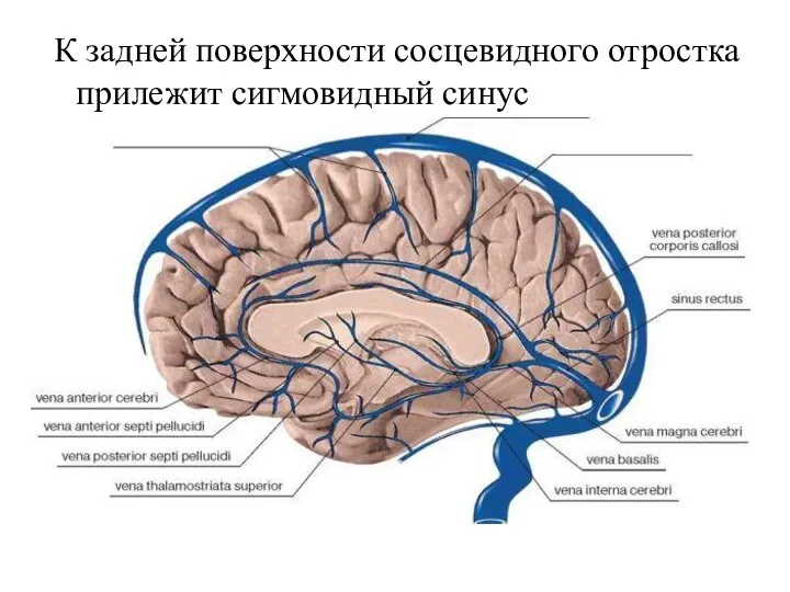 К задней поверхности сосцевидного отростка прилежит сигмовидный синус