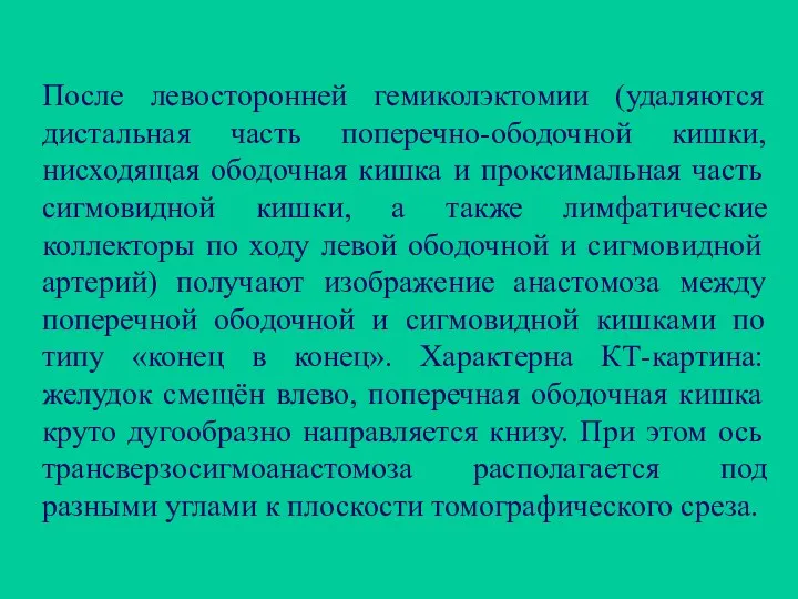 После левосторонней гемиколэктомии (удаляются дистальная часть поперечно-ободочной кишки, нисходящая ободочная