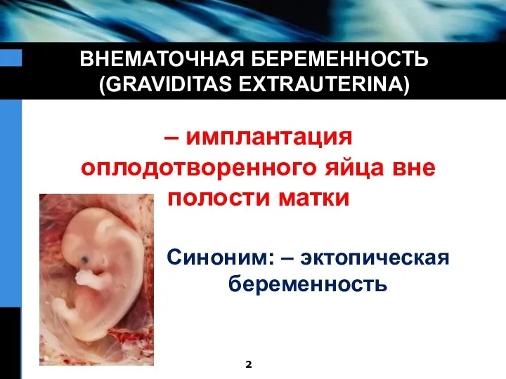 ВНЕМАТОЧНАЯ БЕРЕМЕННОСТЬ (GRAVIDITAS EXTRAUTERINA) – имплантация оплодотворенного яйца вне полости матки Синоним: – эктопическая беременность