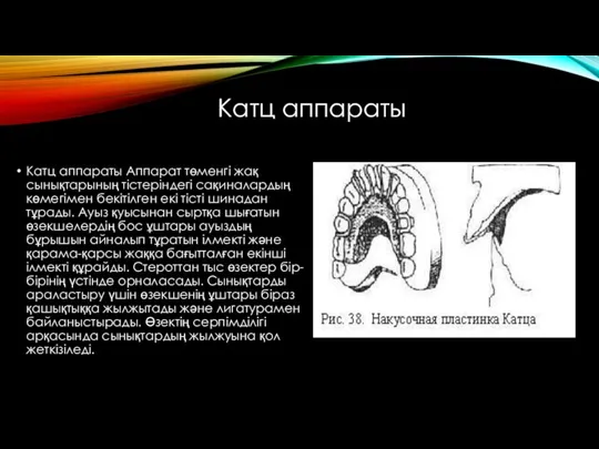 Катц аппараты Катц аппараты Аппарат төменгі жақ сынықтарының тістеріндегі сақиналардың көмегімен бекітілген екі