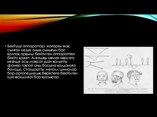 Бекітуші аппараттар: жоғарғы жақ сынған кезде оның сынығын бас қалпақ