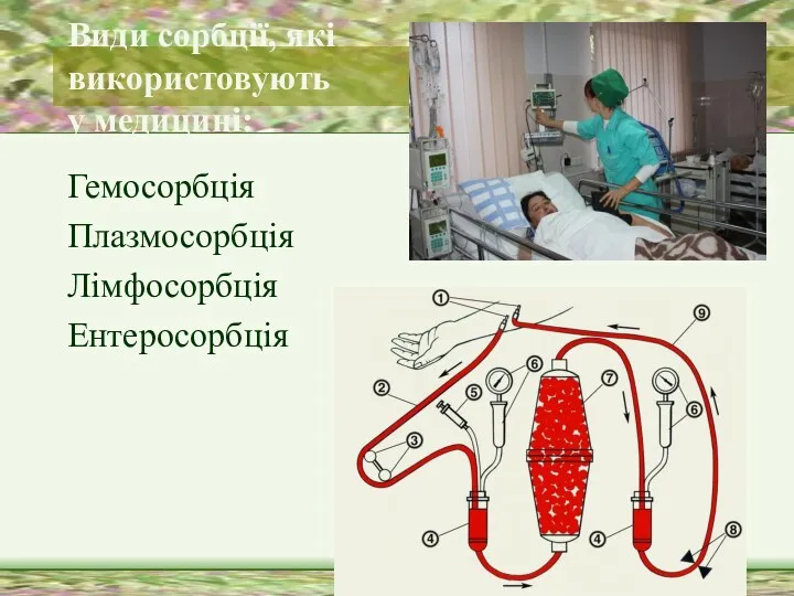 Види сорбції, які використовують у медицині: Гемосорбція Плазмосорбція Лімфосорбція Ентеросорбція