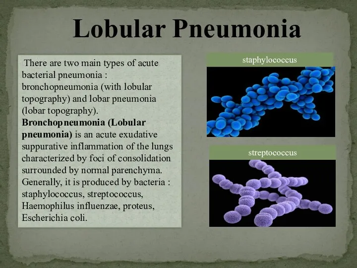 Lobular Pneumonia There are two main types of acute bacterial pneumonia : bronchopneumonia