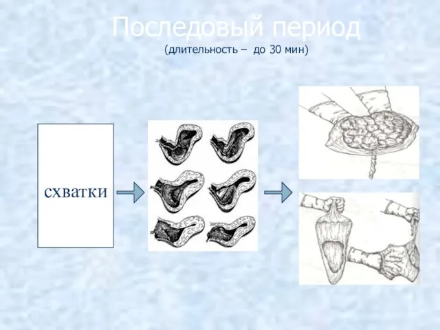 Последовый период (длительность – до 30 мин) схватки