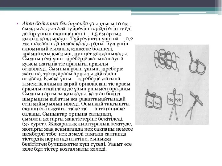 Айви бойынша бекіткенде ұзындығы 10 см сымды алдын ала түйреуіш