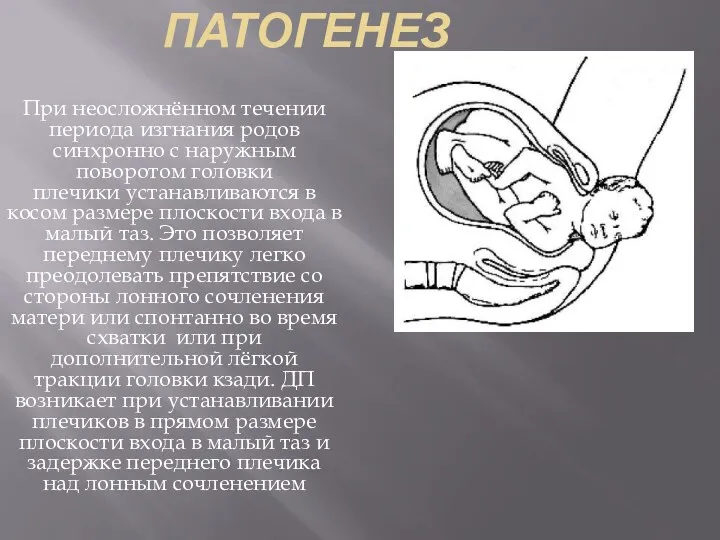 ПАТОГЕНЕЗ При неосложнённом течении периода изгнания родов синхронно с наружным