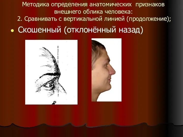 Методика определения анатомических признаков внешнего облика человека: 2. Сравнивать с вертикальной линией (продолжение); Скошенный (отклонённый назад)