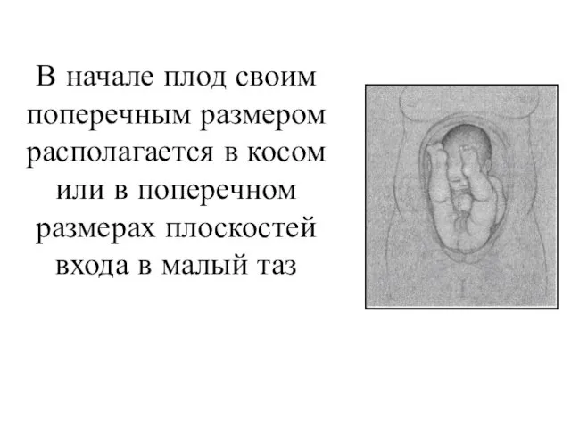 В начале плод своим поперечным размером располагается в косом или