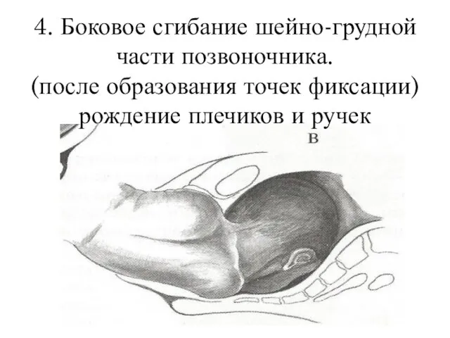 4. Боковое сгибание шейно-грудной части позвоночника. (после образования точек фиксации) рождение плечиков и ручек