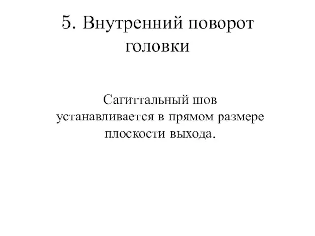 5. Внутренний поворот головки Сагиттальный шов устанавливается в прямом размере плоскости выхода.