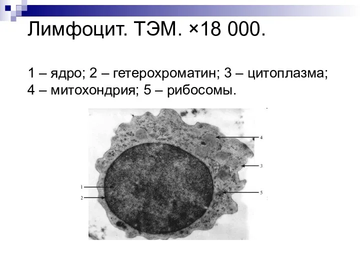 Лимфоцит. ТЭМ. ×18 000. 1 – ядро; 2 – гетерохроматин;