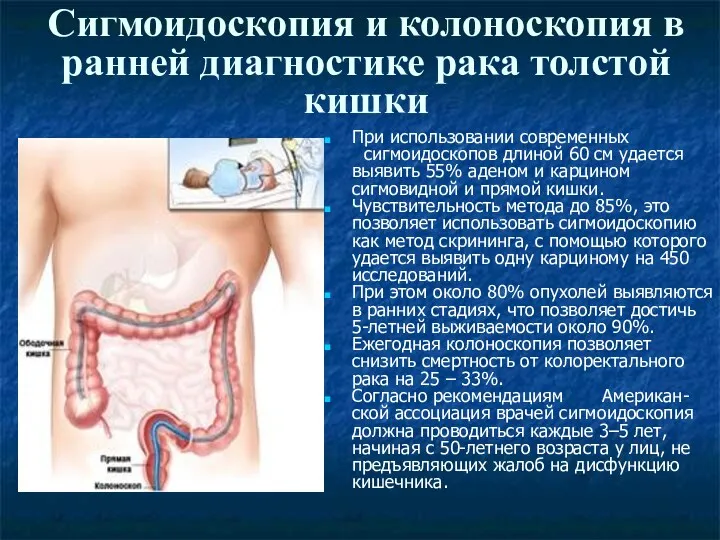 Сигмоидоскопия и колоноскопия в ранней диагностике рака толстой кишки При