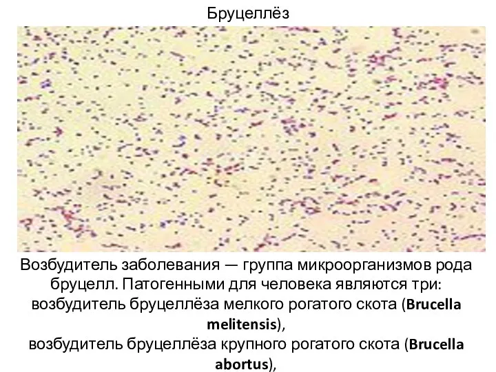 Бруцеллёз Возбудитель заболевания — группа микроорганизмов рода бруцелл. Патогенными для
